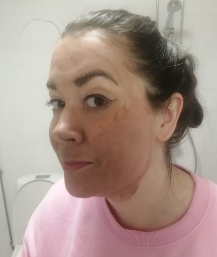 Leahlani Honey Love kasvokuorinta kasvoilla.